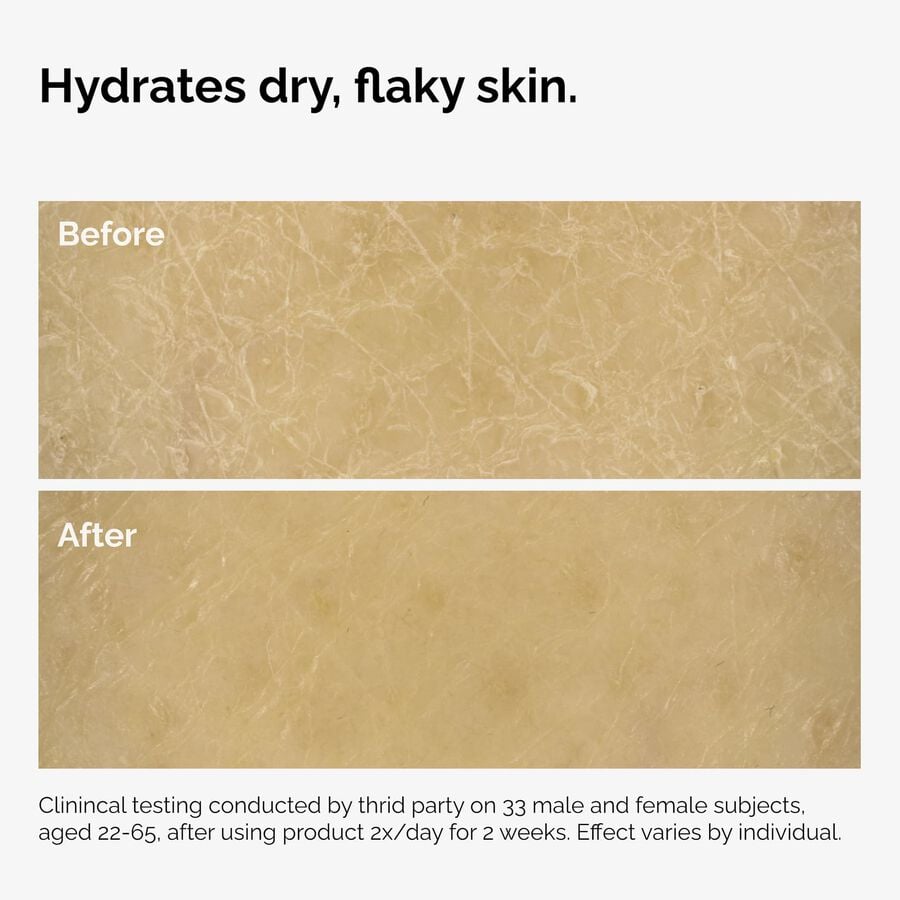 the-body-care-collection-s6 ord-natural-moisturizing-factors-inulin-body-before-after-graphic-02.jpg