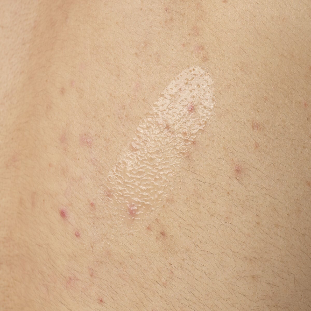 salicylic-acid-0-5-body-serum-n8 ORD-salicylic-acid-05-body-240ml-application.jpg