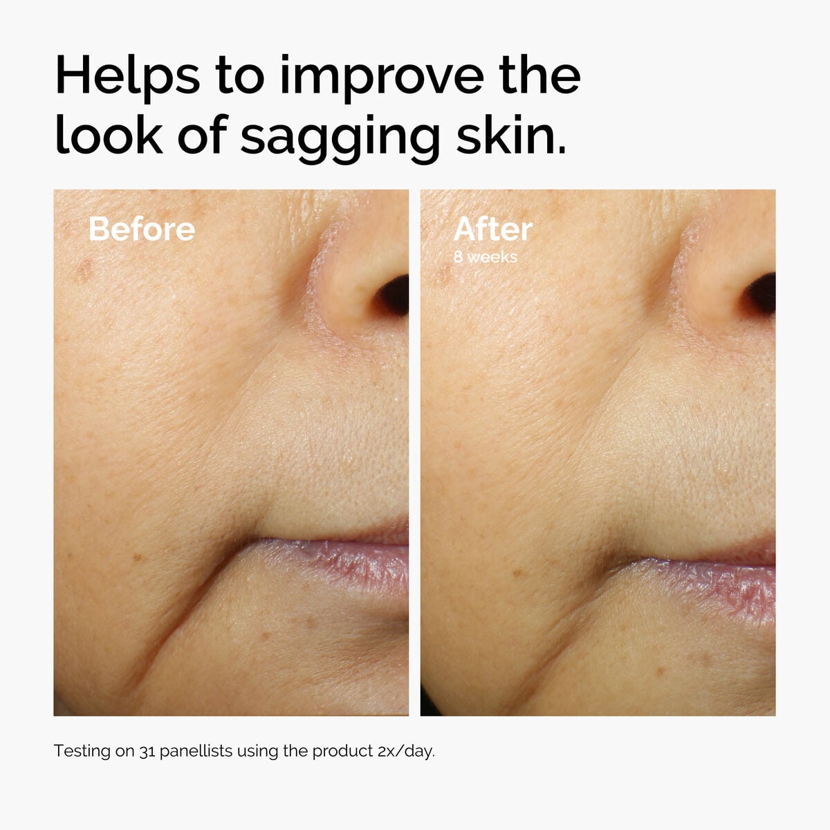 caffeine-3-escin-1-face-serum-k4 ord-caffeine-3pct-escin-1pct-face-serum-before-after-sagging.jpg