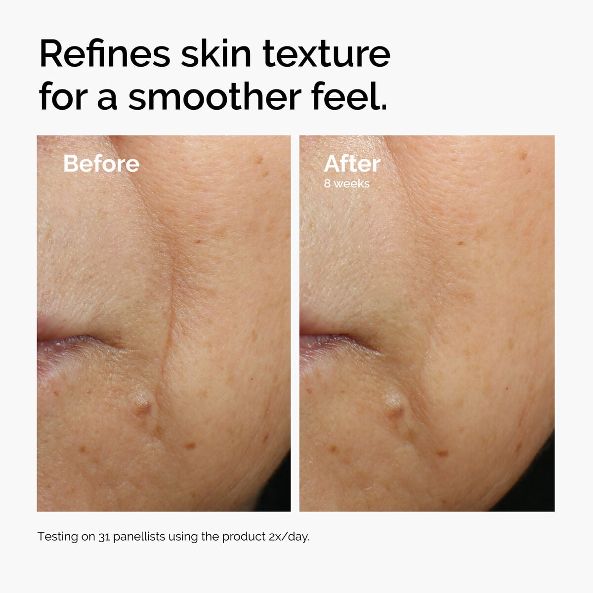 caffeine-3-escin-1-face-serum-k4 ord-caffeine-3pct-escin-1pct-face-serum-before-after-texture.jpg