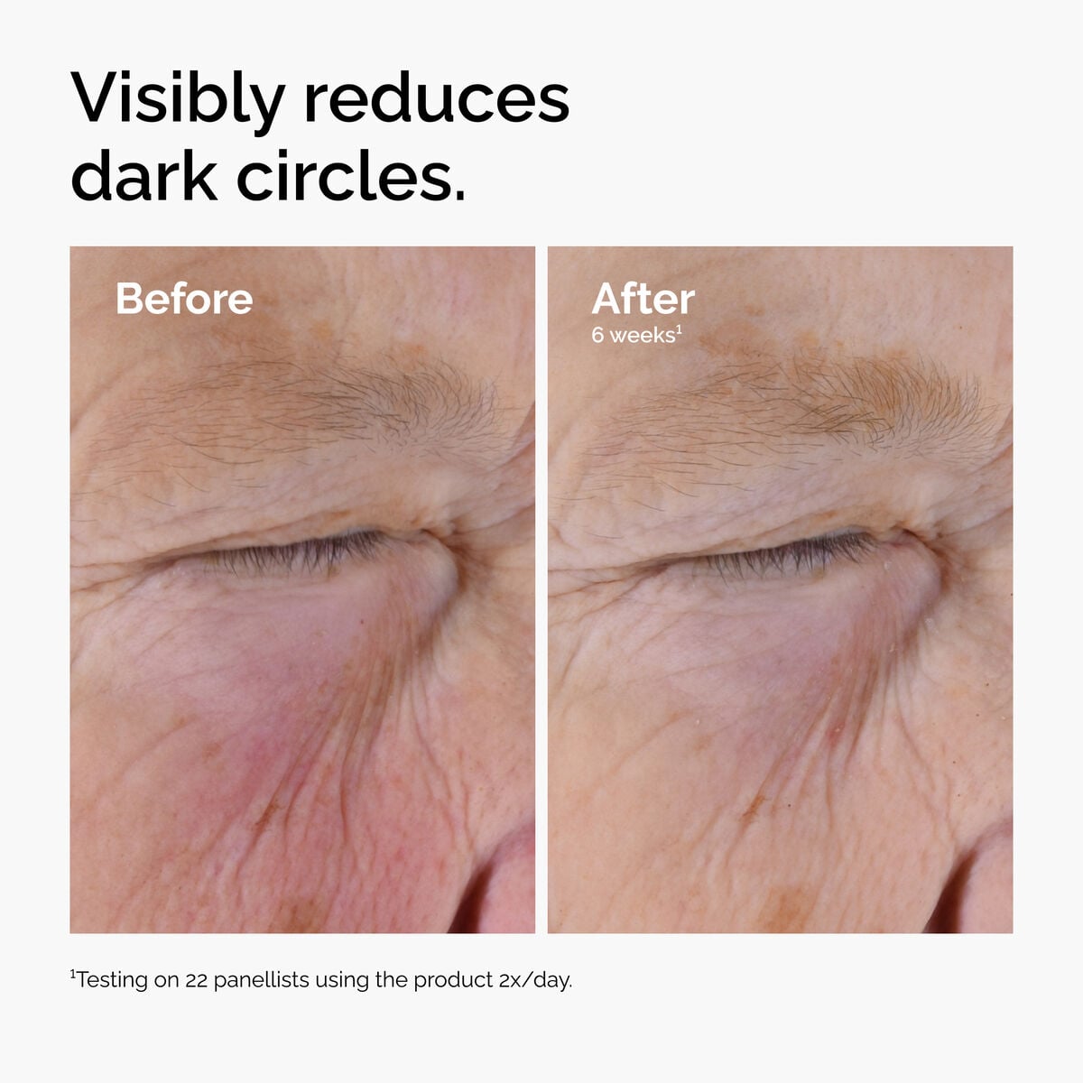 caffeine-solution-5-egcg-eye-serum-s7 ord-caffeine-solution-egcg-dark-circles-before-after.jpg