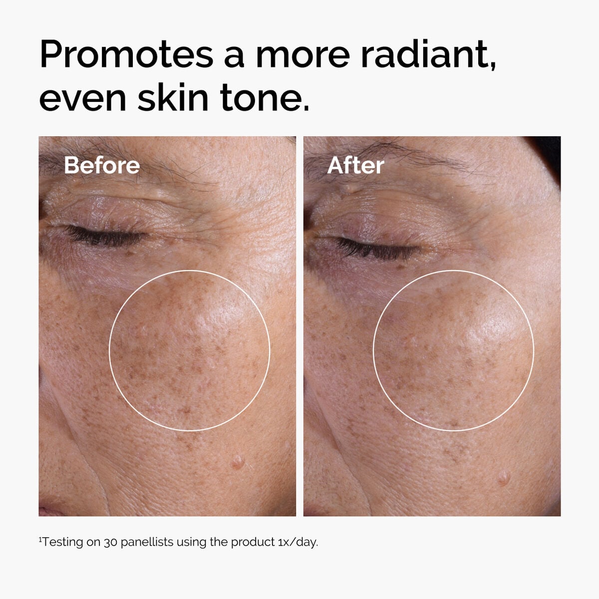 glycolic-acid-7-exfoliating-toner-y3 ord-glycolic-before-after-radiance.jpg