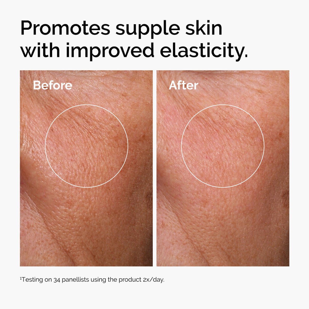 hyaluronic-acid-2-b5-with-ceramides-e8 ord-hyaluronic-acid-2pct-b5-hydrating-serum-before-after-elasticity.jpg