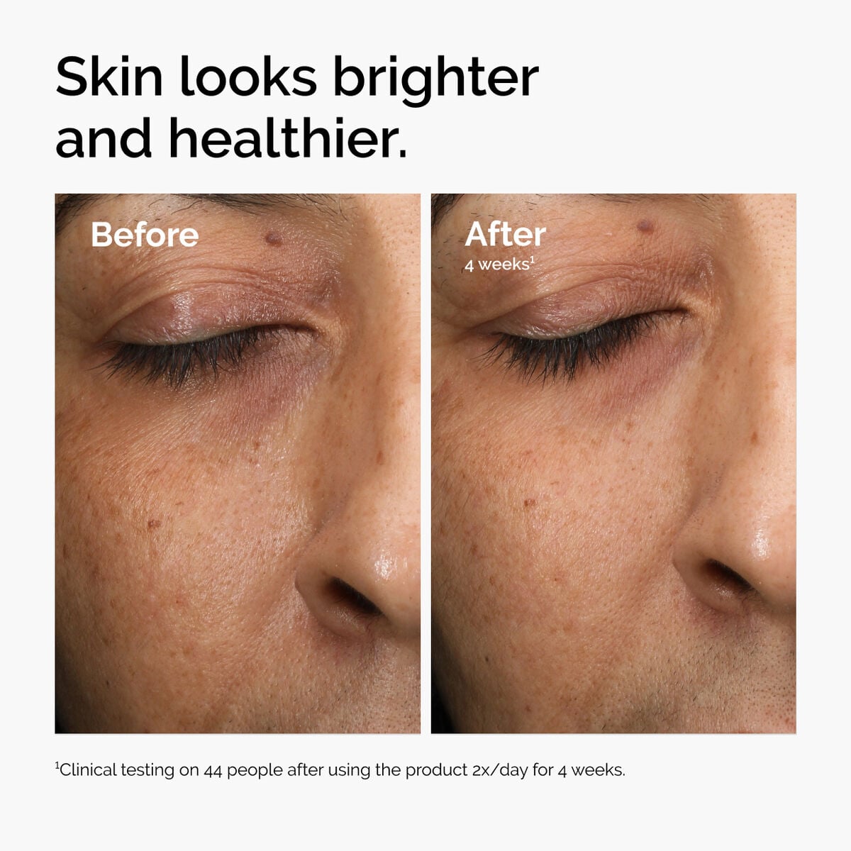 multi-antioxidant-radiance-serum-y0 ord-mars-before-after-healthy.jpg