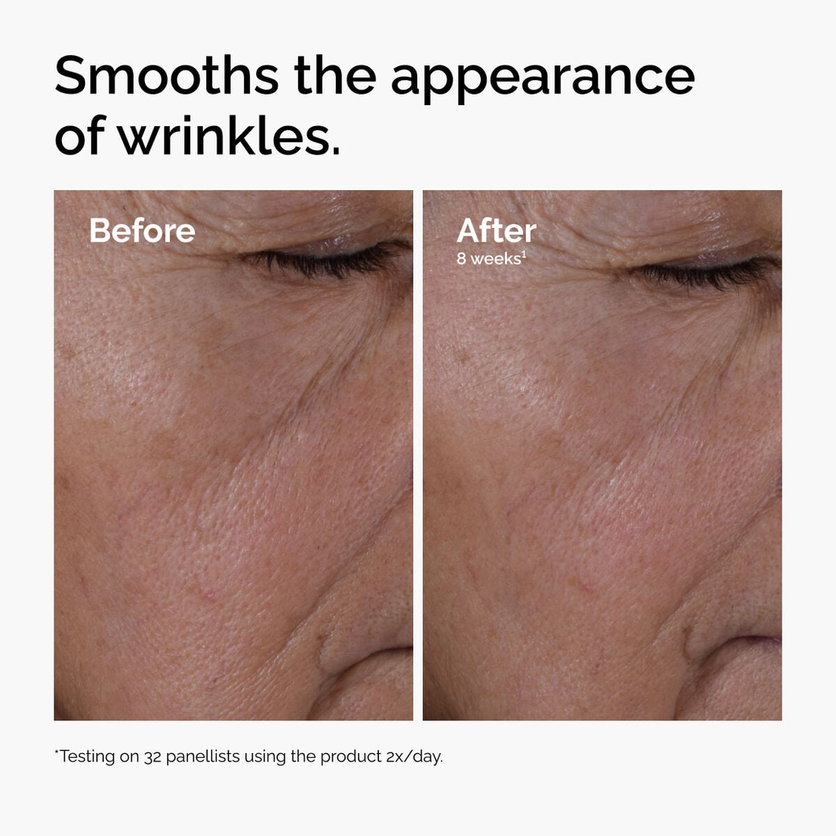 multi-peptide-ha-serum-t4 ord-multi-peptide-ha-serum-wrinkles-before-after.jpg