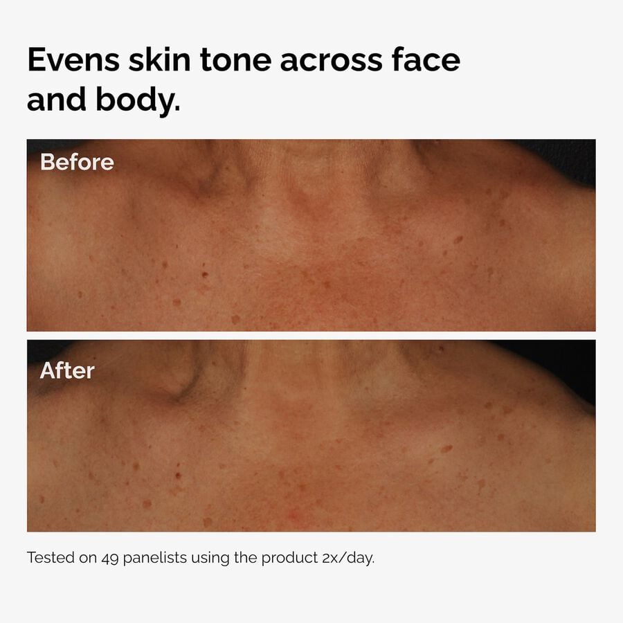 the-body-care-collection-s6 ord-niacinamide-face-body-serum-before-after-even-tone-graphic.jpg