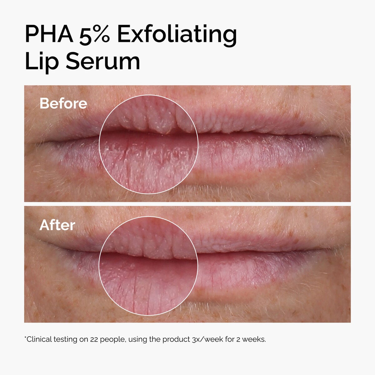 pha-5-exfoliating-lip-serum-i1 ord-pha-5pct-lip-exfoliating-serum-before-after.jpg